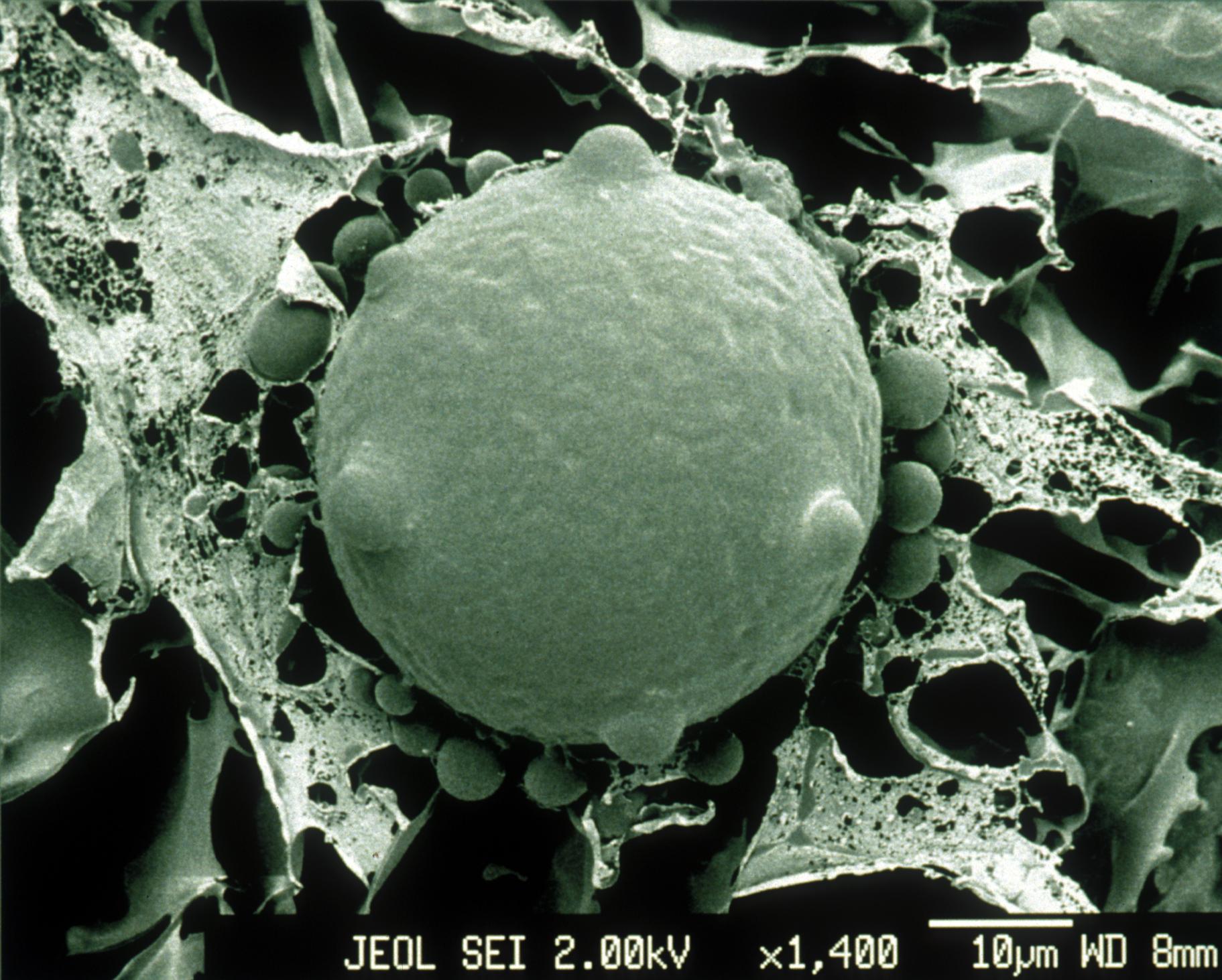 Scanning electron micrograph of a frozen intact zoospore and sporangia of the chytrid fungus (Batrachochytrium dendrobatidis).